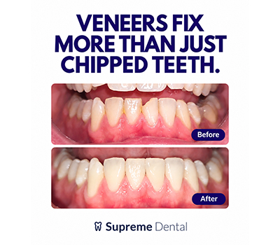 Supreme-Dental_Mobile-Banner_1 (1) (1)