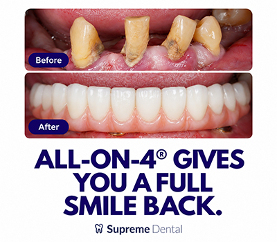 Supreme-Dental_Mobile-Banner_2 (1) (1)